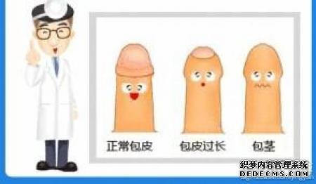 �����пƣ������ж��Ƿ��ǰ�Ƥ������