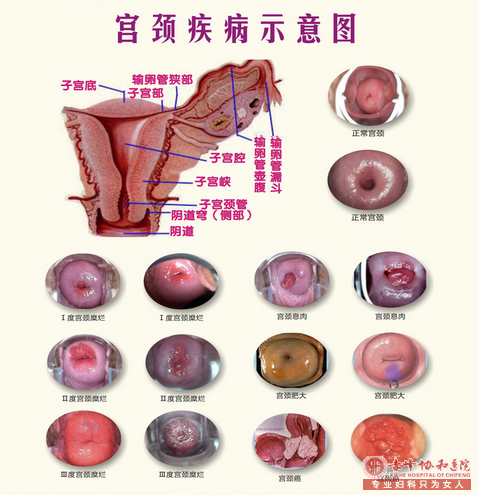 ���HPV���Ծ�һ����ù�������?